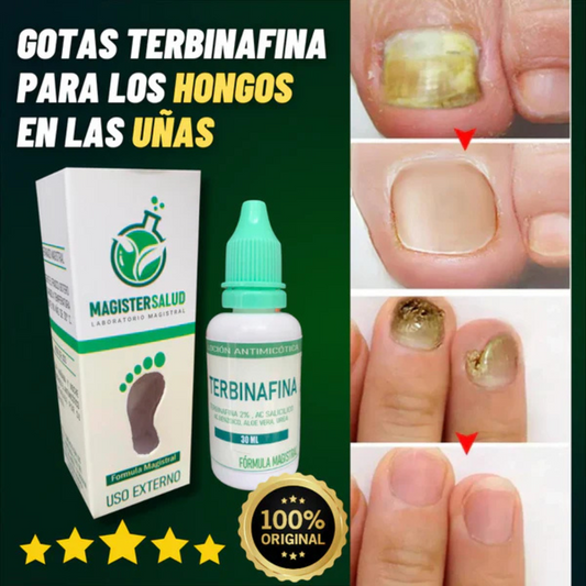 GOTAS ANTIMICOTICAS PARA UÑAS